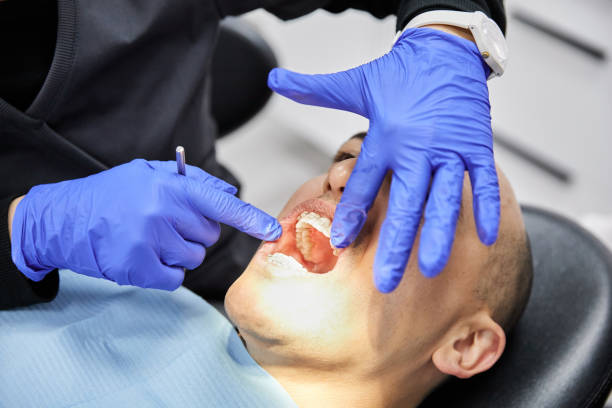 Best Dental Abscess Treatment in Rockville, MD